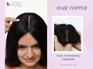 5 Things About Hair Topper For Thinning Crown You Should Know