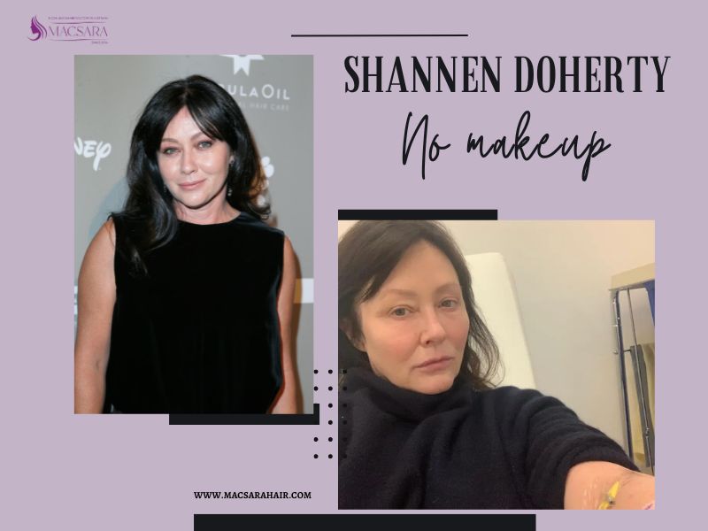 Shannen Doherty No Makeup: Natural Beauty Revealed