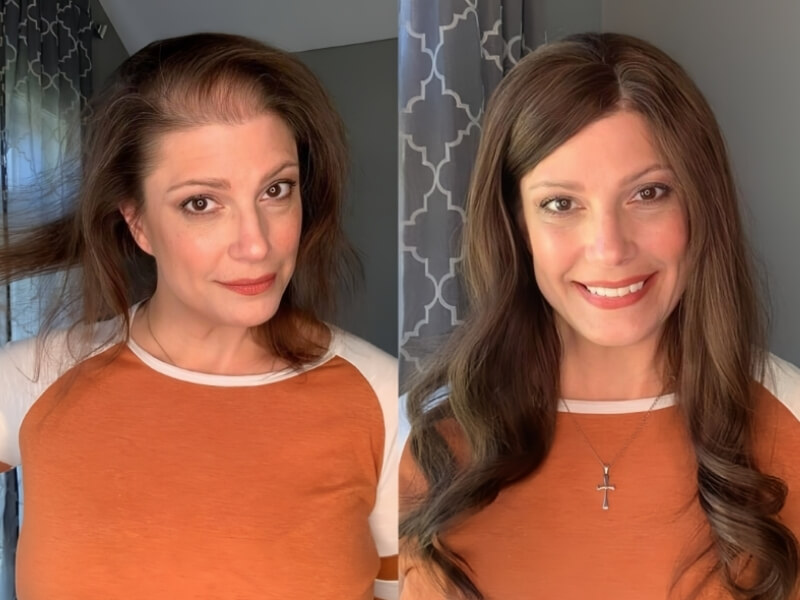 A mono hair topper instantly boosts your hair’s volume